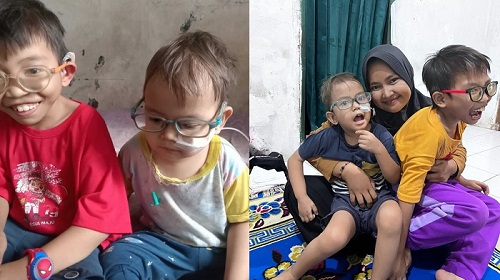 Bantu Kakak Beradik Yang Mengidap Penyakit Langka