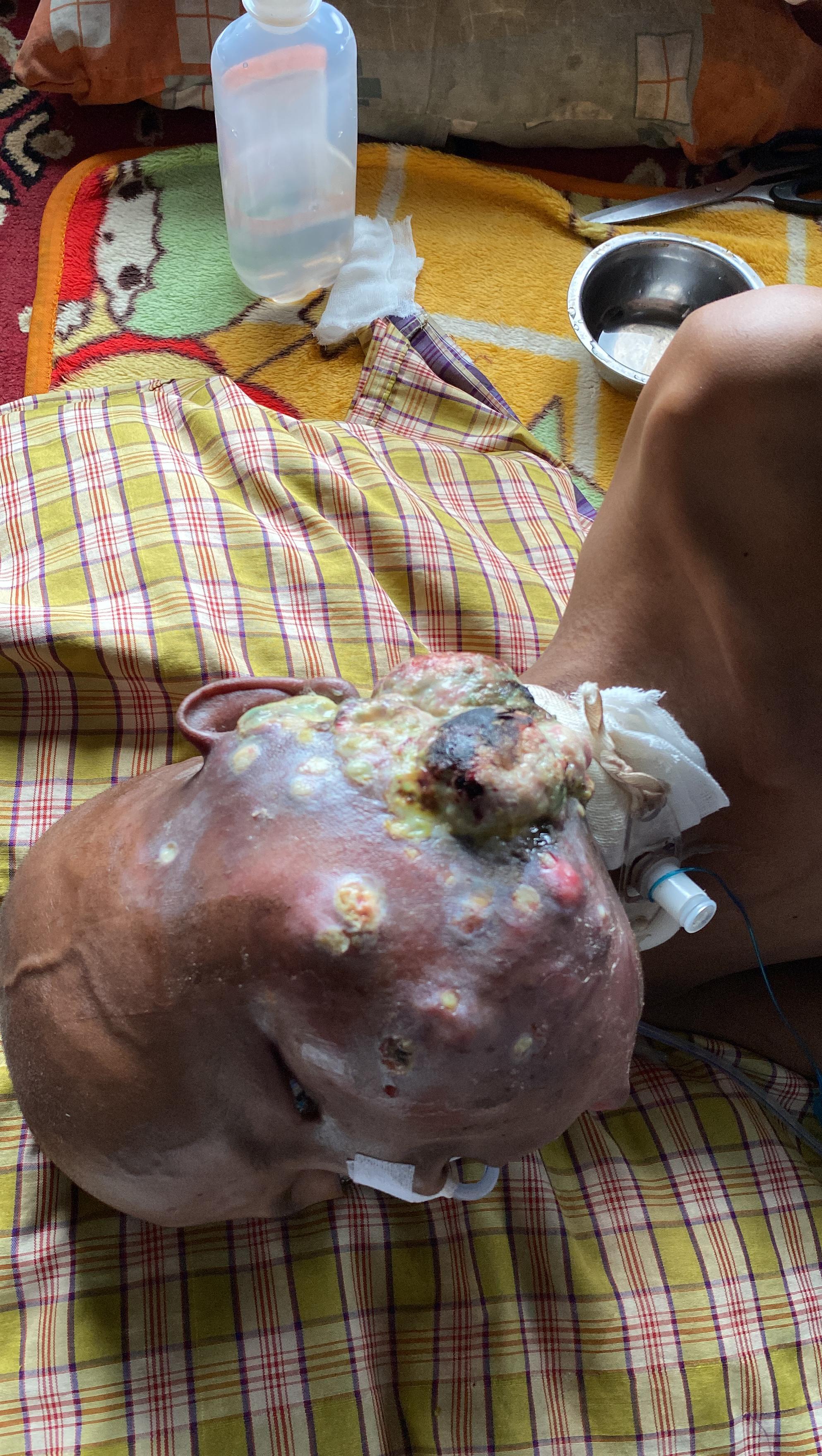 Jaga Harapan Selamatkan Para Pejuang Kesembuhan
