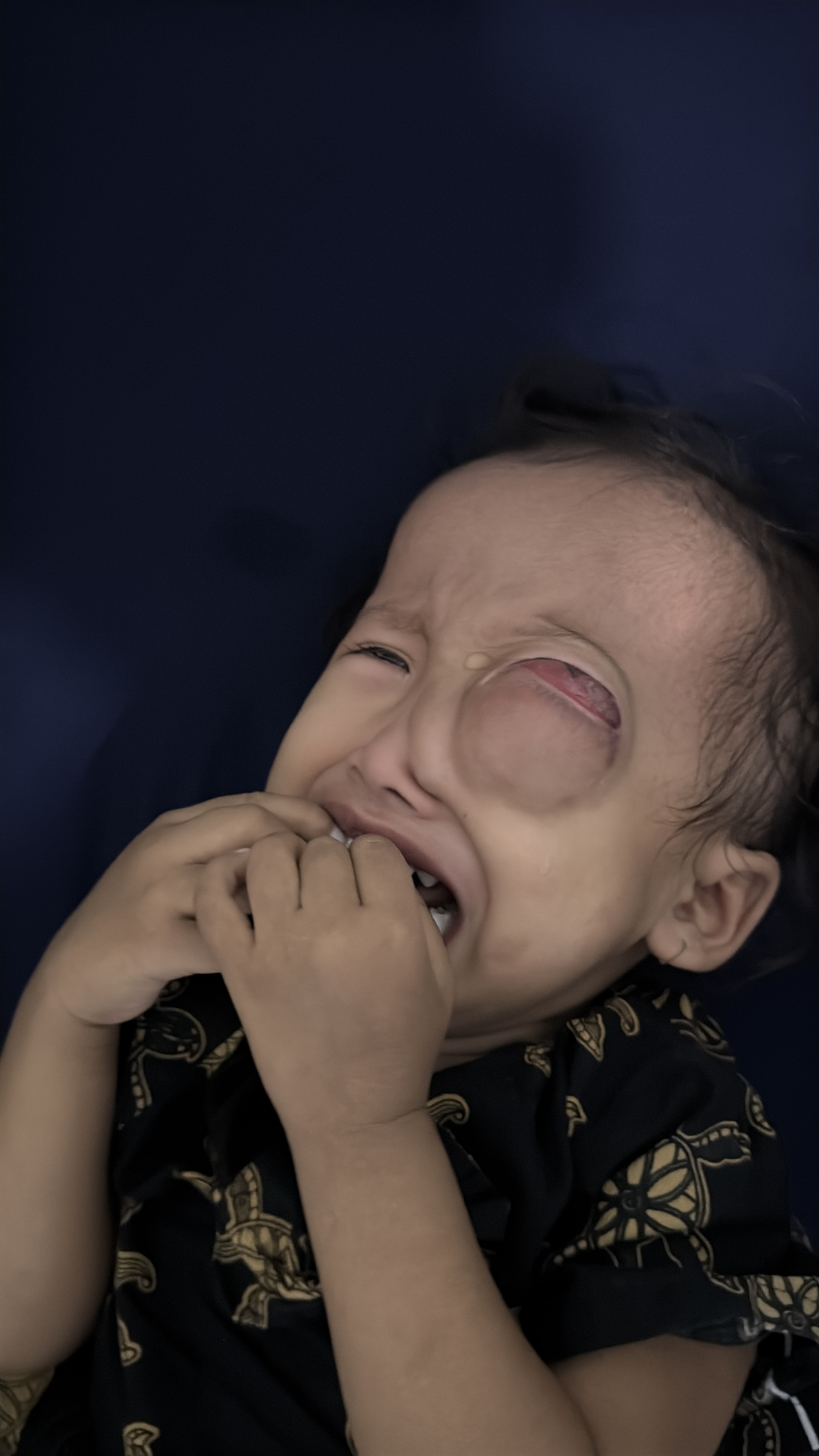 Tolong Anak Penjual Tisu Matanya Menonjol dan Tak Bisa Melihat