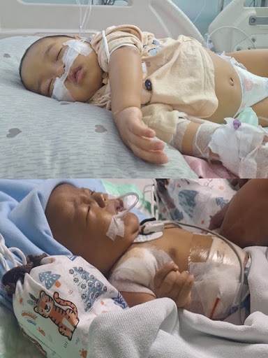 Ayah Siap Donor Hati untuk Selamatkan Imam