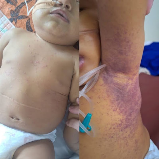 Ayah Siap Donor Hati untuk Selamatkan Imam