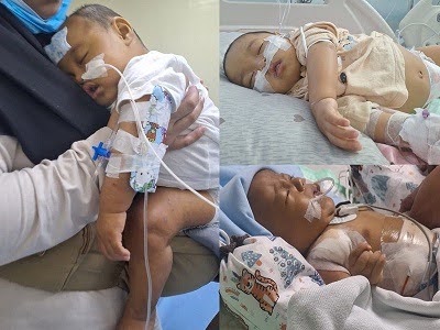 Ayah Siap Donor Hati untuk Selamatkan Imam
